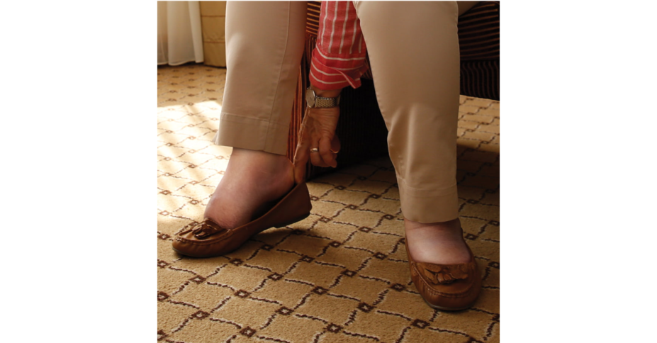 Swelling image